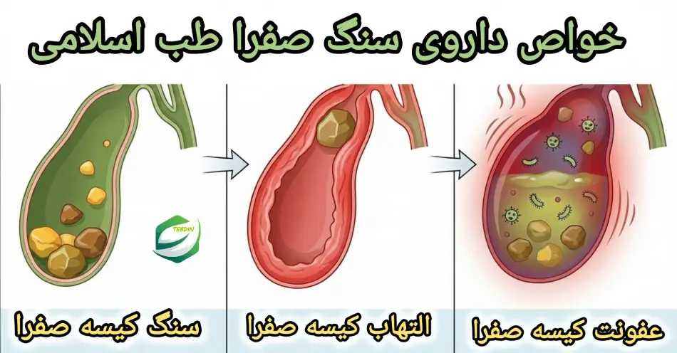 خواص داروی سنگ صفرا طب اسلامی