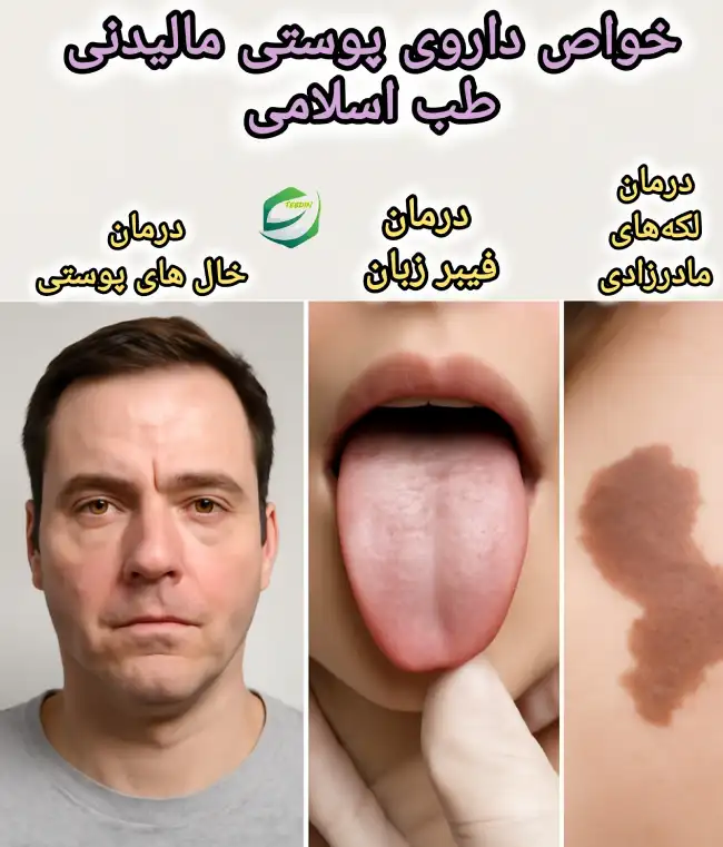 خواص داروی پوستی مالیدنی طب اسلامی