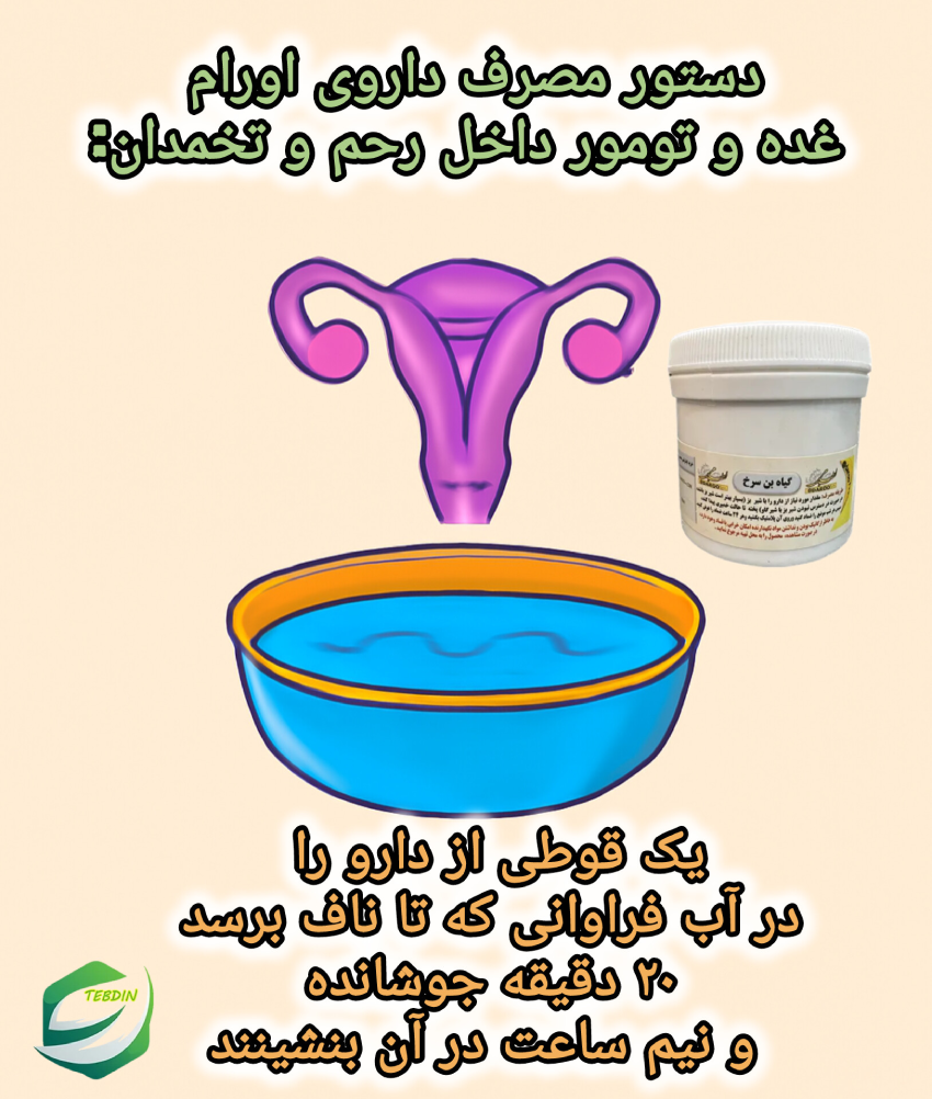 داروی اورام برای غده و تومور داخل رحم و تخمدان