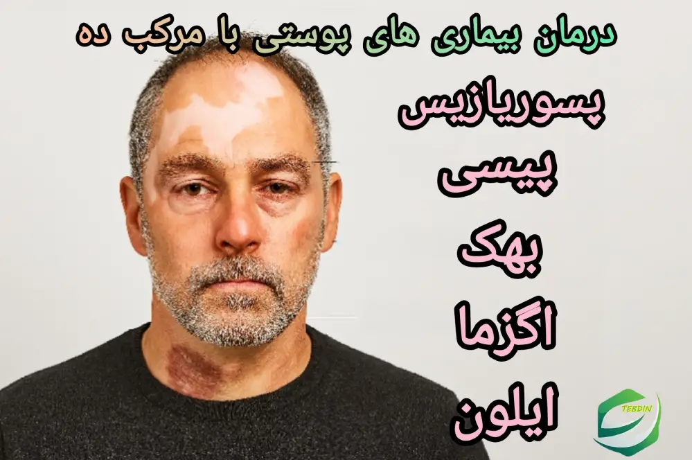 درمان بیماری های پوستی با مرکب ده