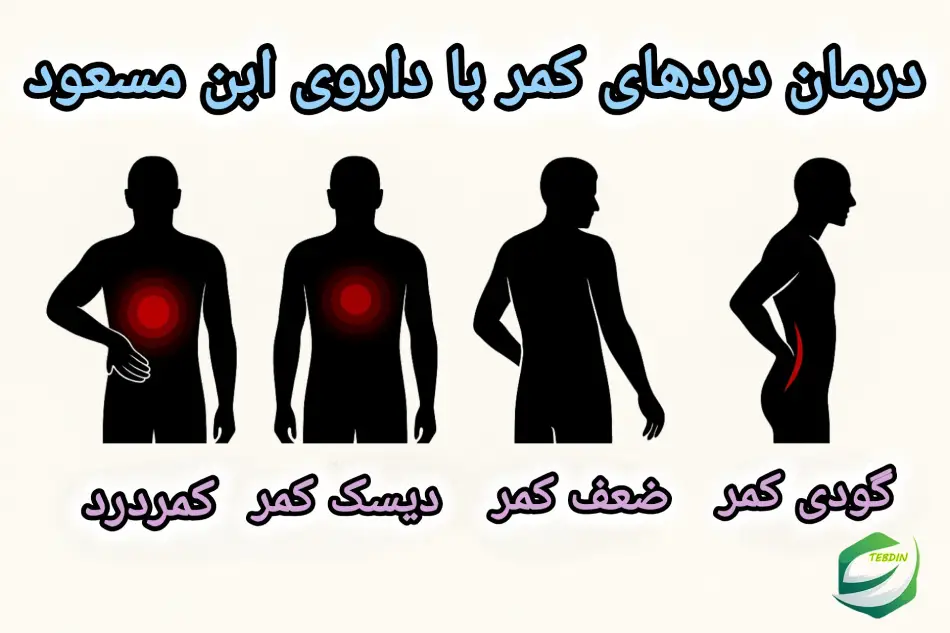 درمان درهای کمر با داروی ابن مسعود