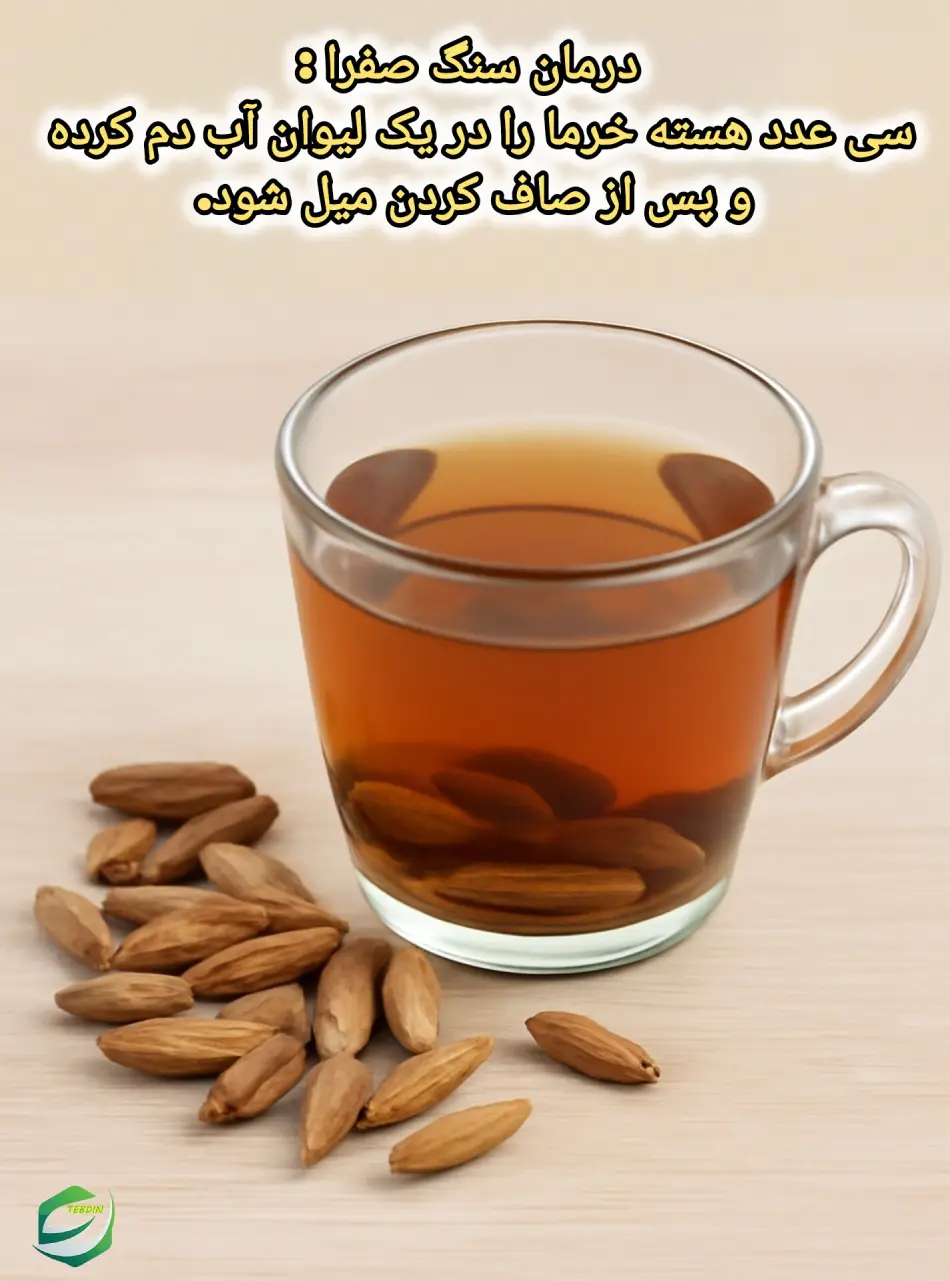 درمان سنگ صفرا با هسته خرما