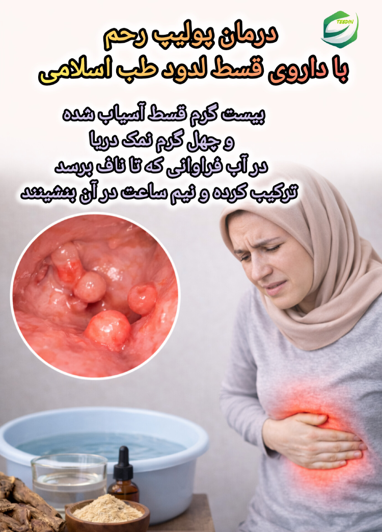 درمان پولیپ رحم با داروی قسط لدوود طب اسلامی