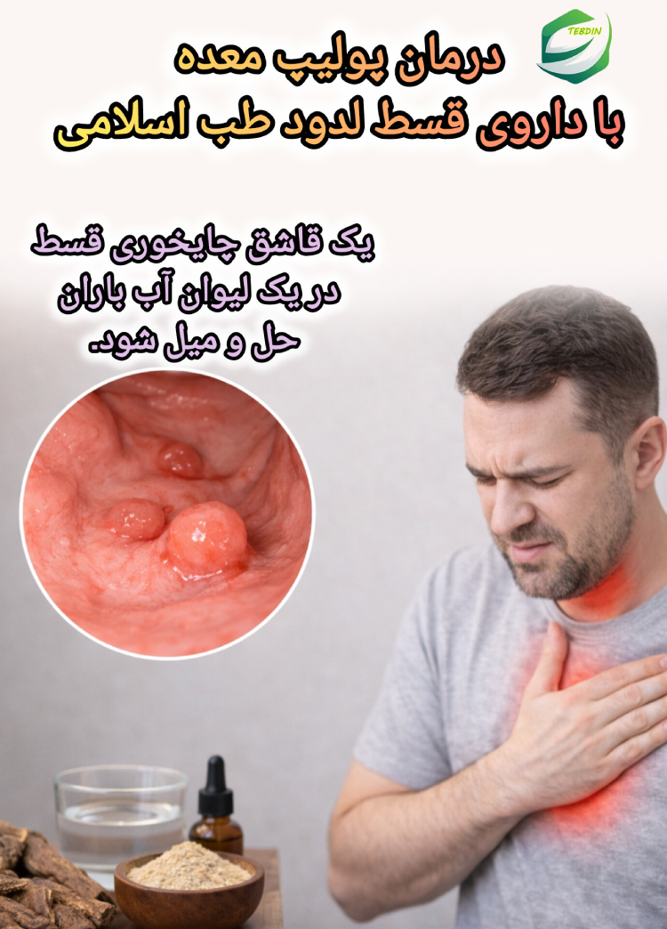 درمان پولیپ معده با داروی قسط لدود طب اسلامی
