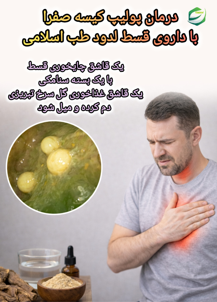 درمان پولیپ کیسه صفرا با داروی قسط لدو طب اسلامی