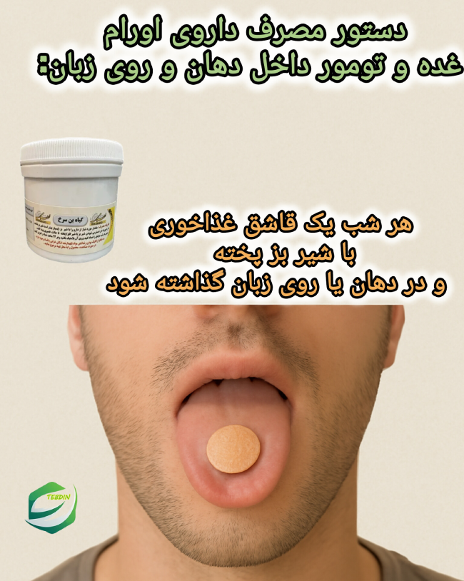 دستور مصرف داروی اوران برای غده و تومور داخل دهان و روی زبان