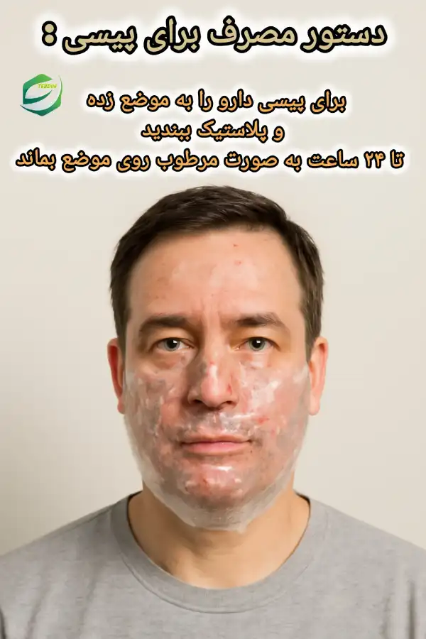 دستور مصرف داروی پوستی مالیدنی برای پیسی