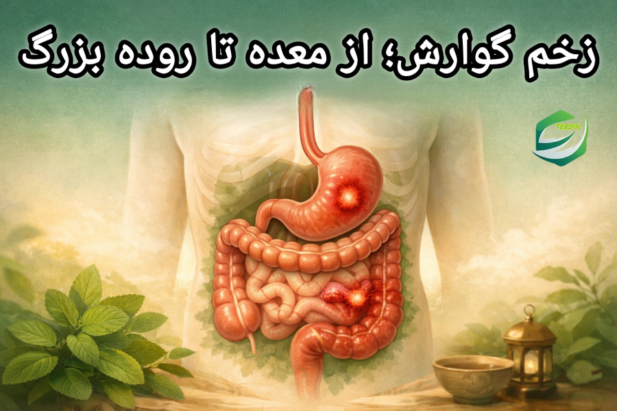 زخم گوارش از معده تا روده بزرگ