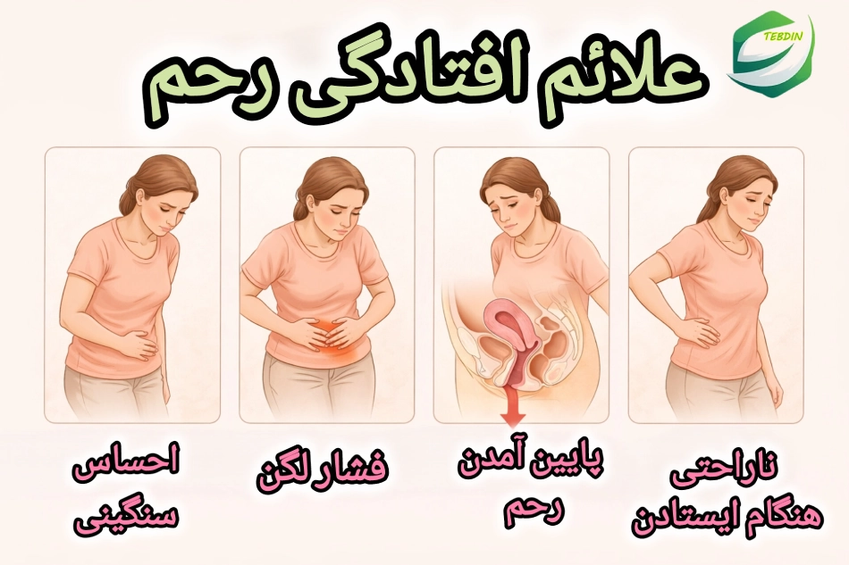 افتادگی رحم 4 علائم افتادگی رحم