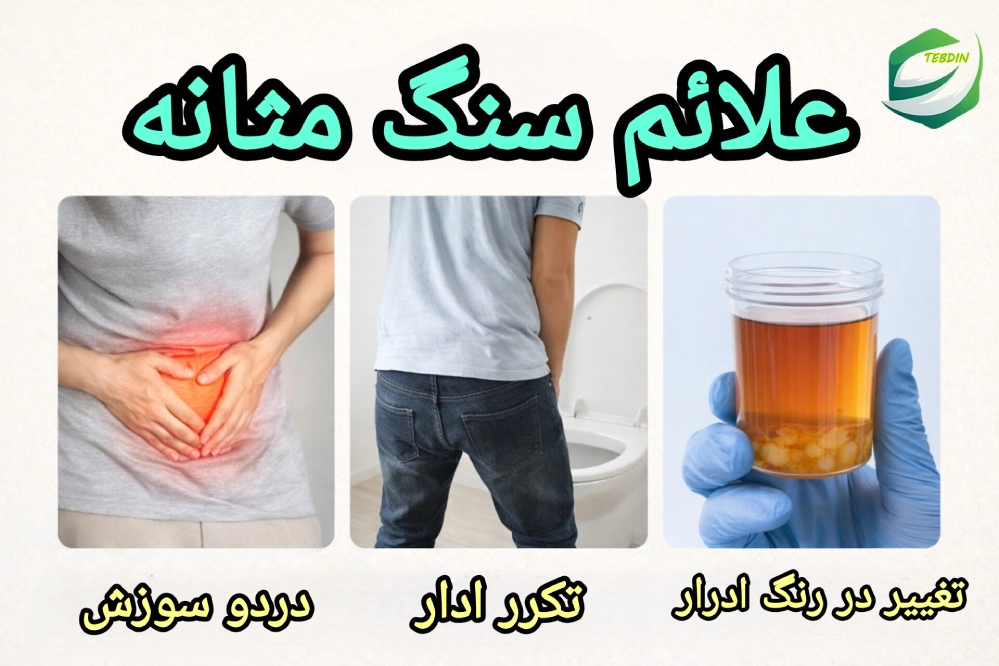 علائم سنگ مثانه چیست؟