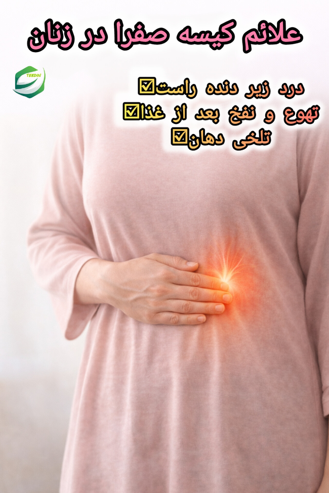 علائم کیسه صفرا در زنان