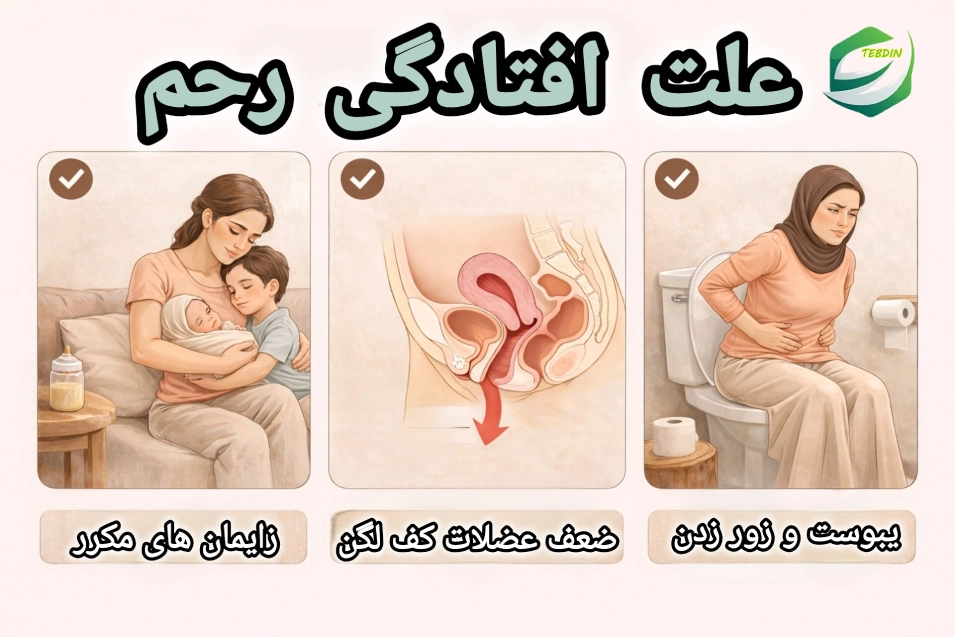 افتادگی رحم 3 علت افتادگی رحم