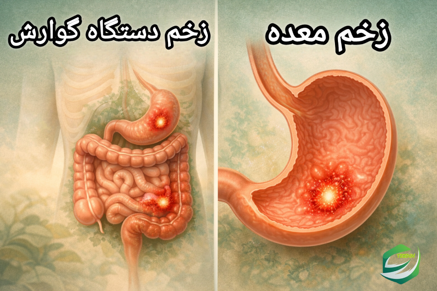 عکس زخم معده و زخم دستگاه گوارش