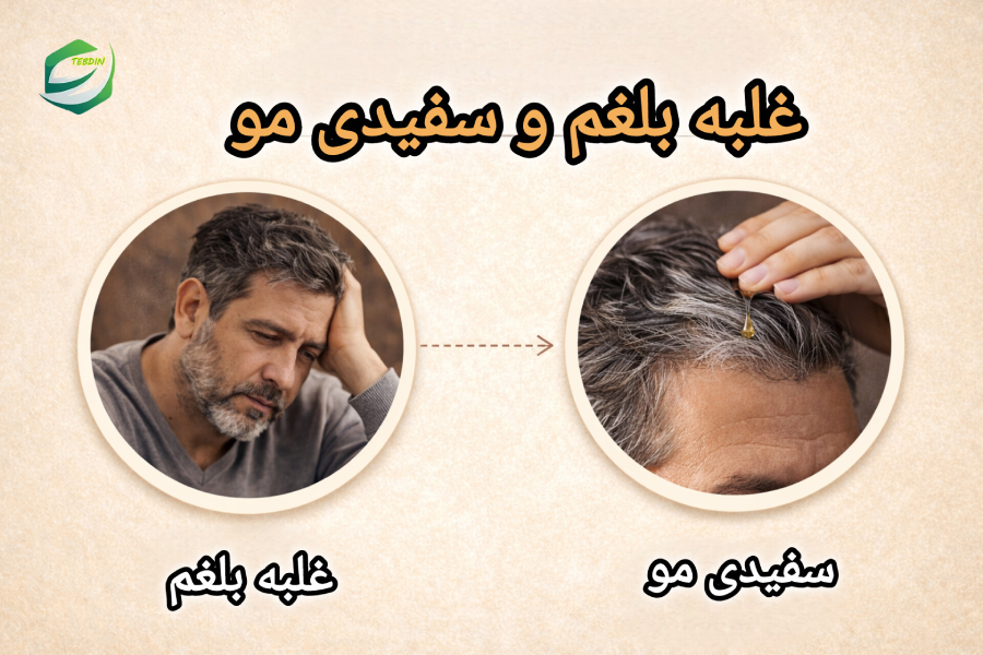 غلبه بلغم و سفیدی مو