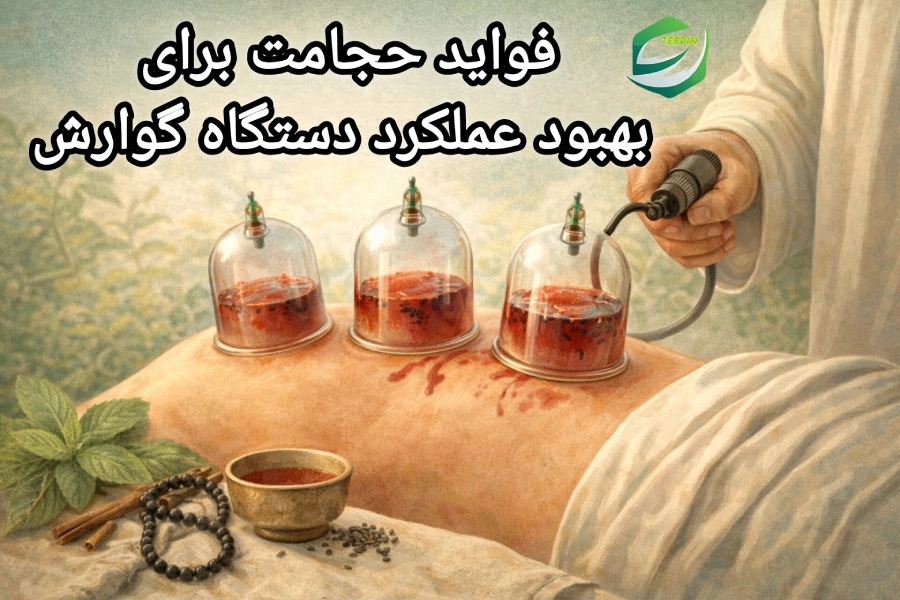 فواید حجامت برای بهبود عملکرد دستگاه گوارش