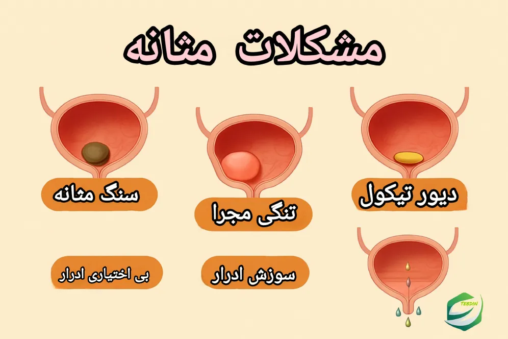 مشکلات مثانه