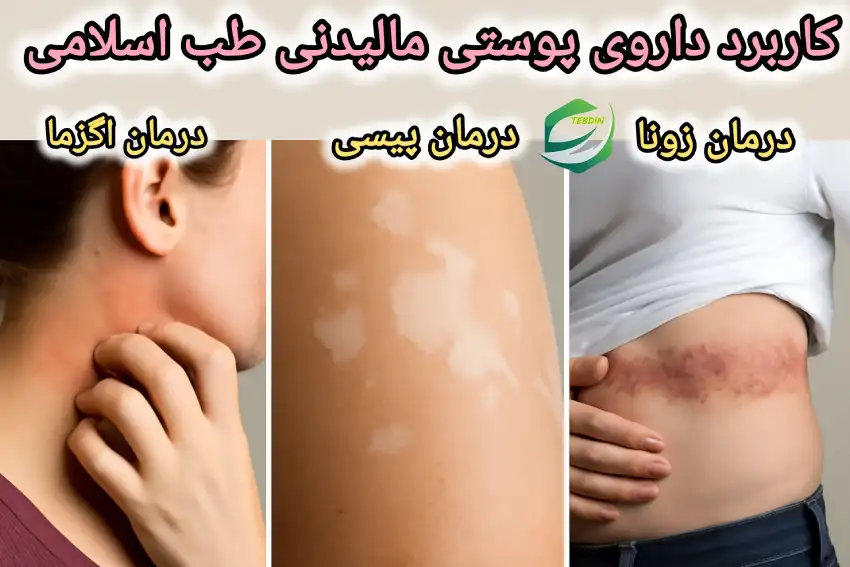 کاربرد داروی پوستی مالیدنی طب اسلامی