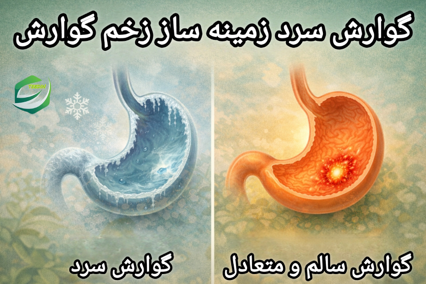 گوارش سرد زمینه ساز زخم گوارش