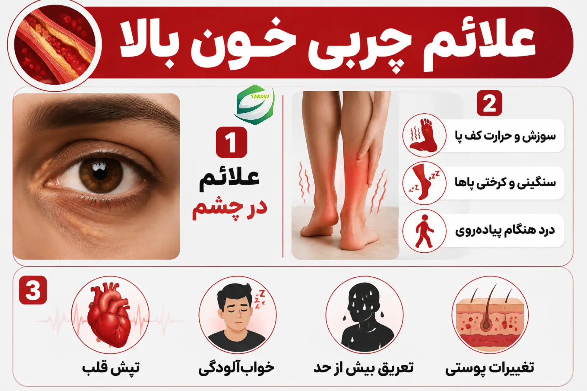 علائم چربی خون بالا