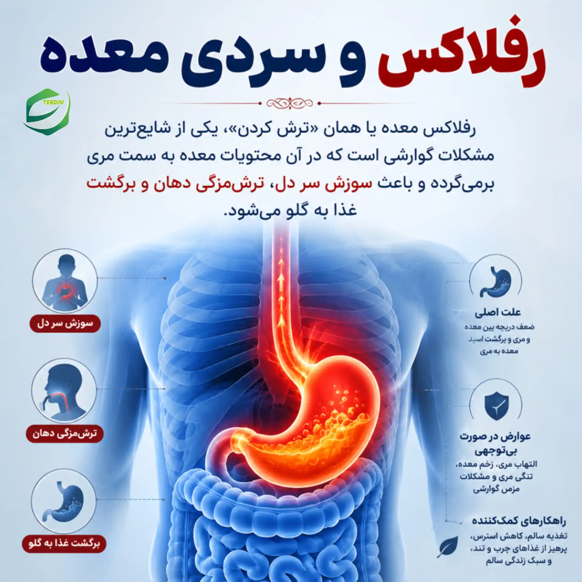 رفلاکس و سردی معده