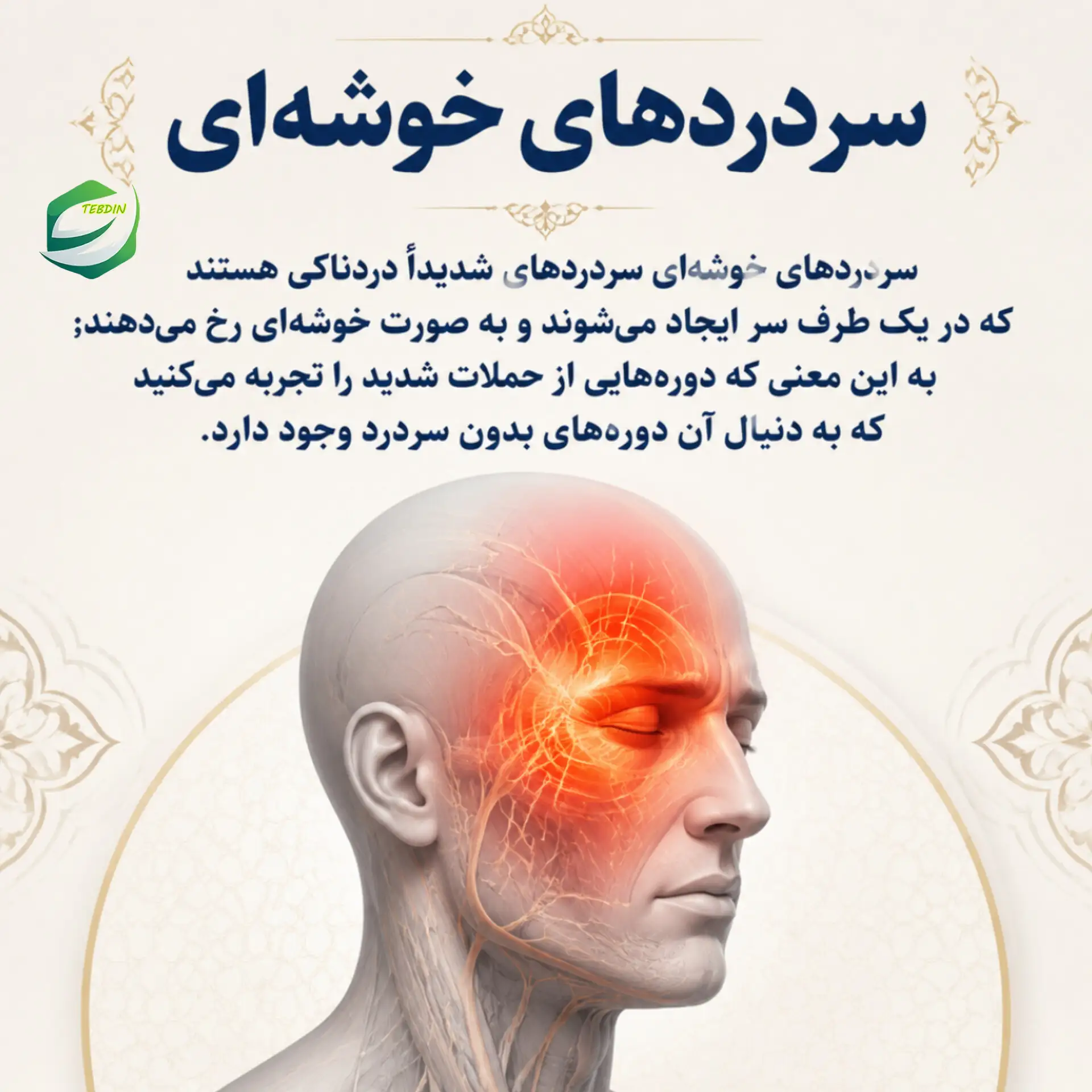 سردردهای خوشه ای