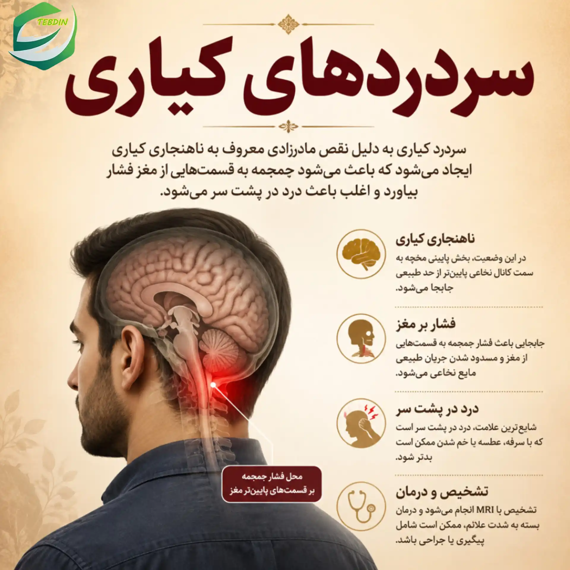 سردردهای کیاری