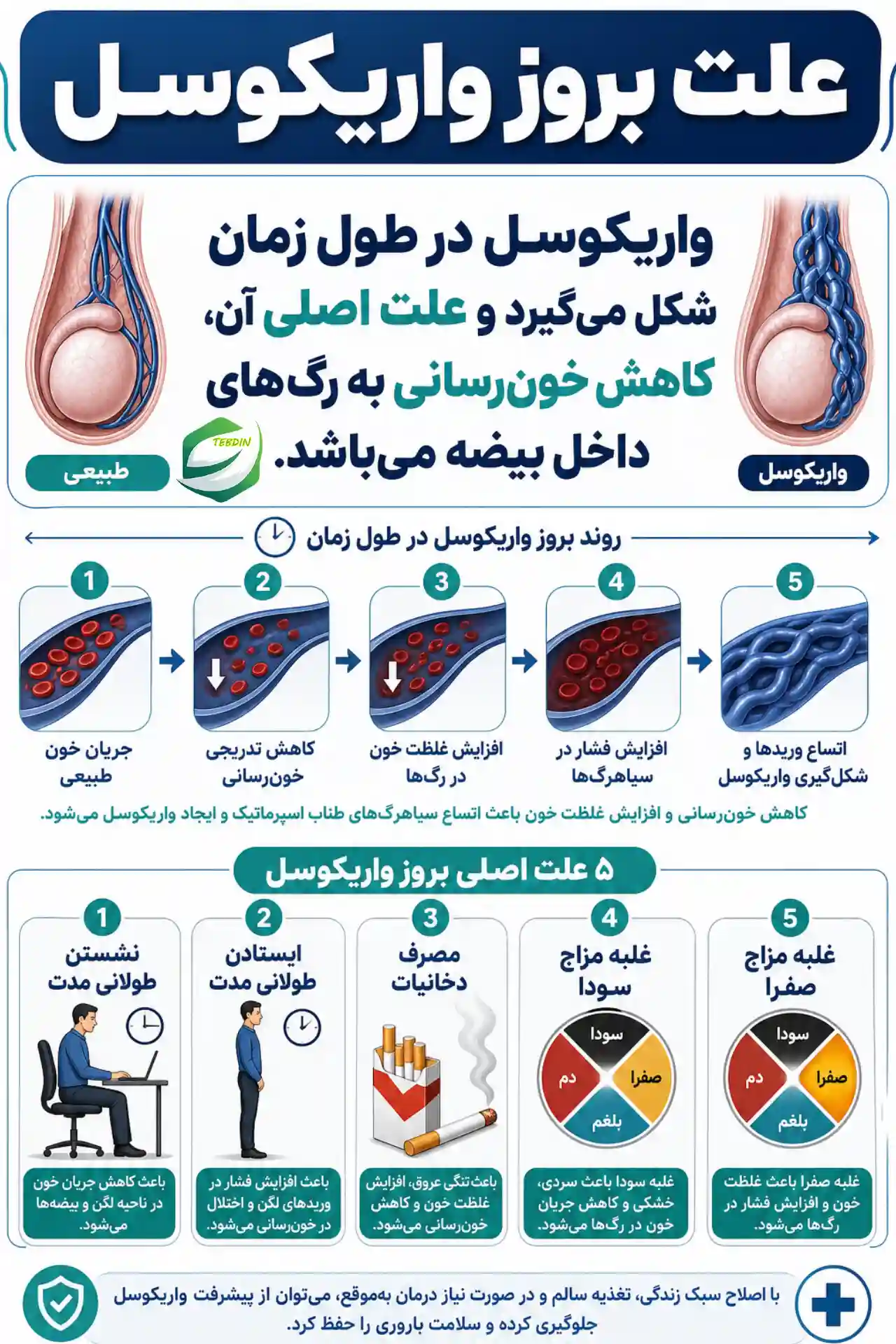 علت بروز واریکوسل