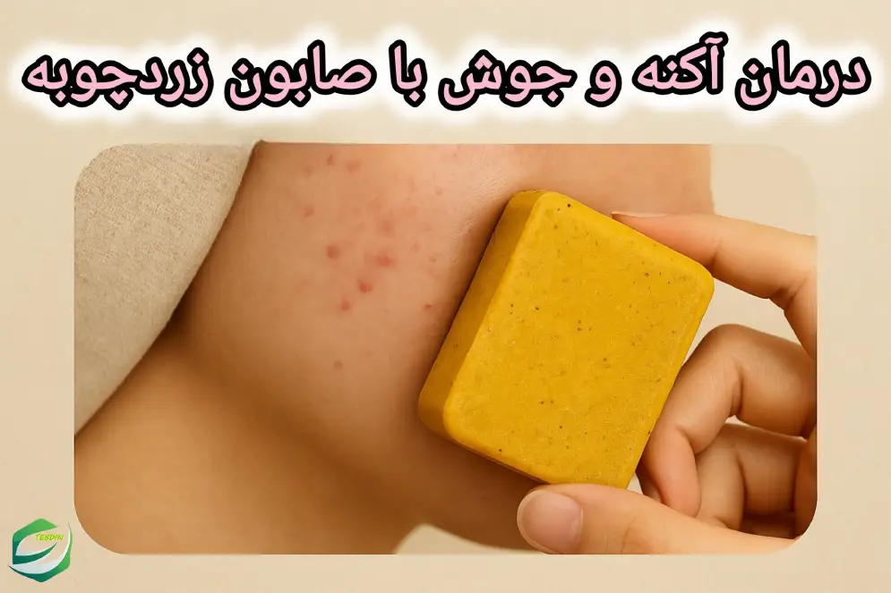 درمان آکنه و جوش با صابون زردچوبه 1