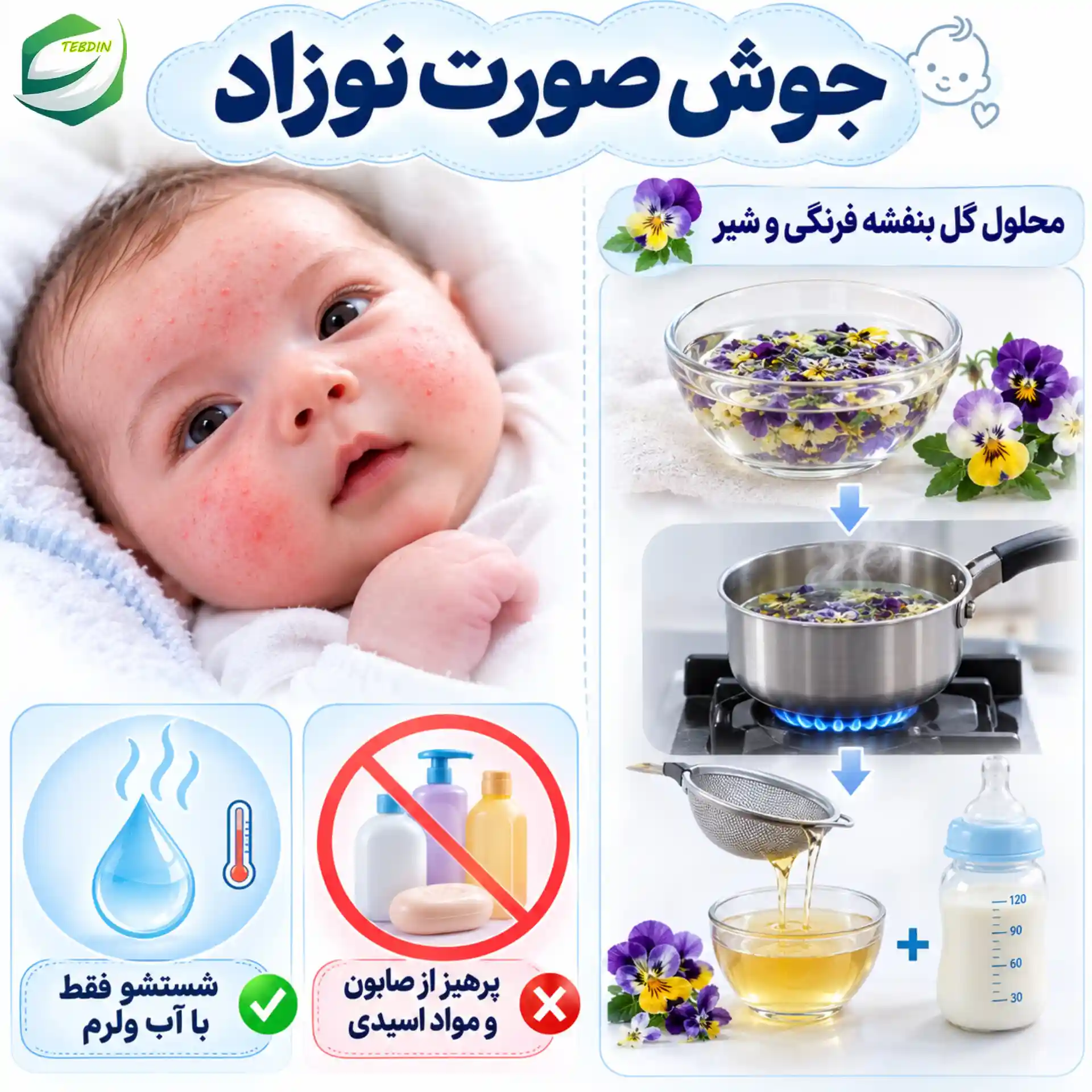 جوش صورت نوزاد