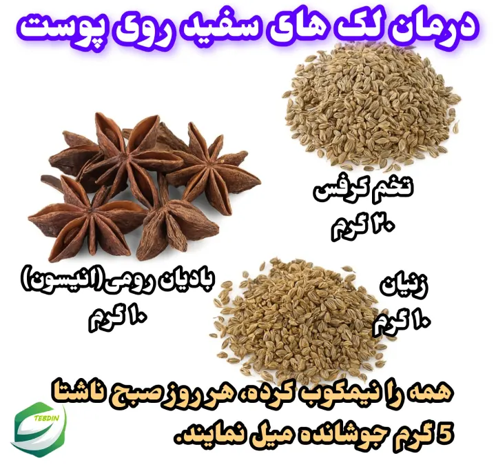 درمانی گیاهی لک های سفید 