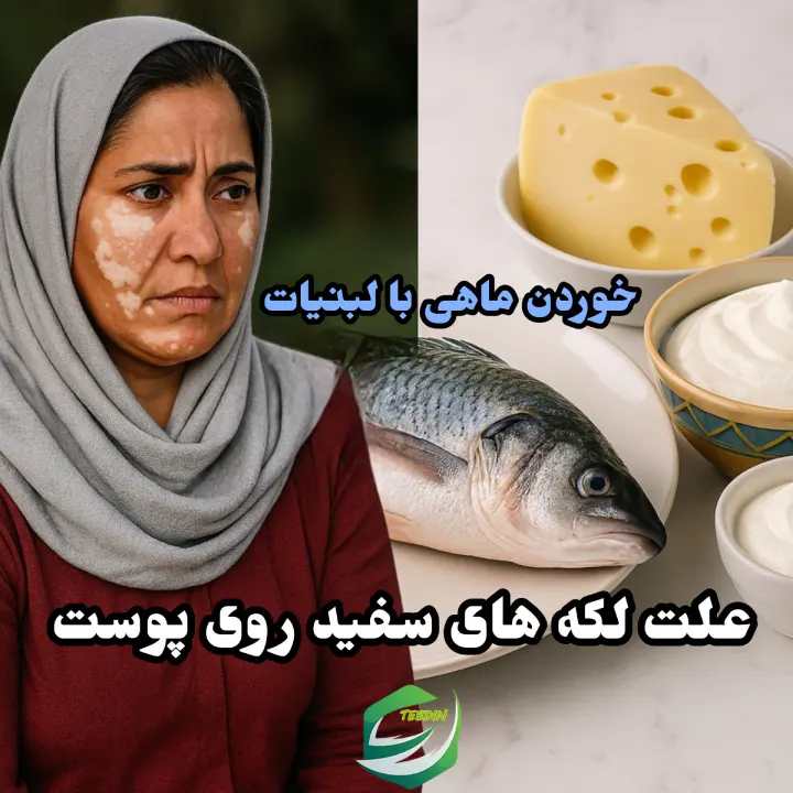 علت لک های سفید روی پوست