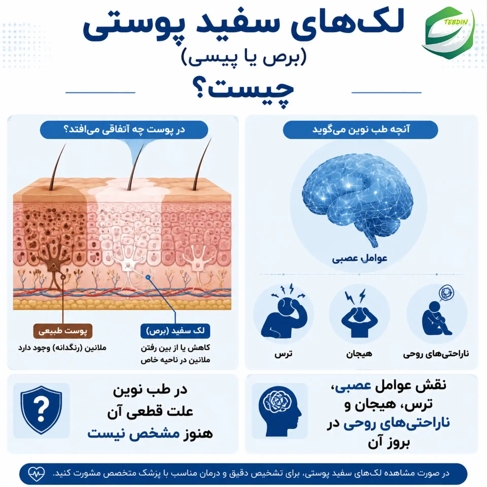 لک های سفید پوستی برص یا پیسی چیست؟