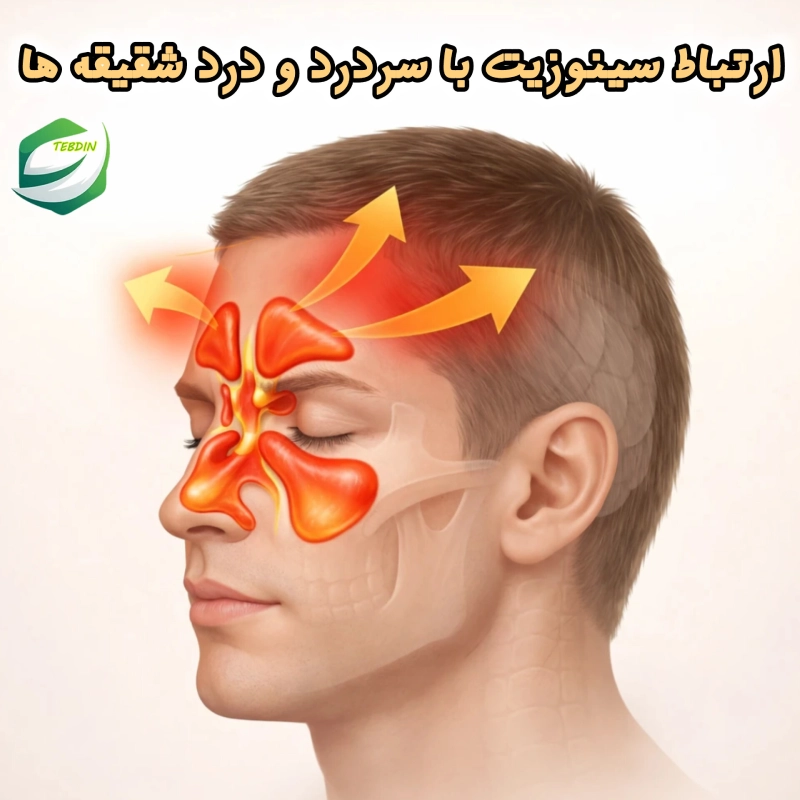 ارتباط سینوزیت ا سردرد و درد شقیقه ها 1