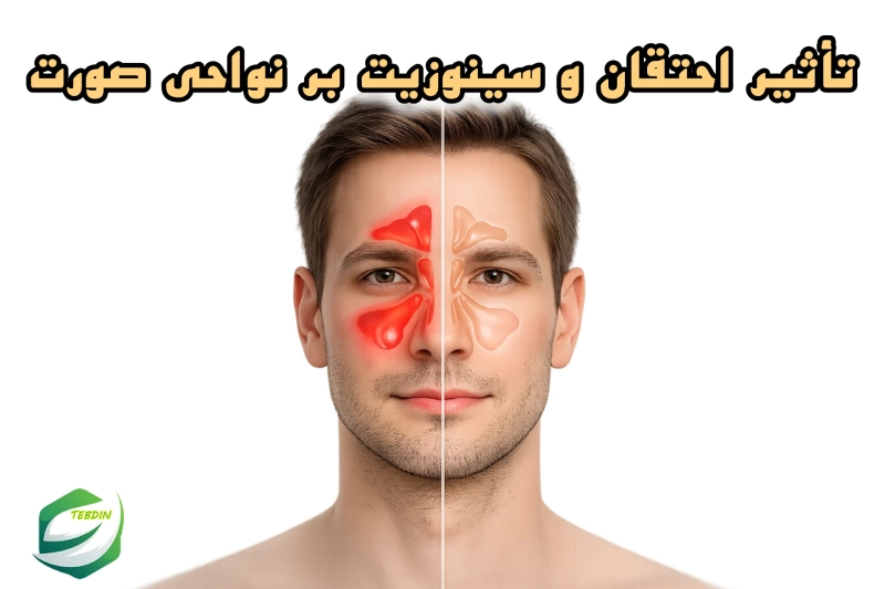 تاثیر احتقان و سینوزیت بر نواحی صورت