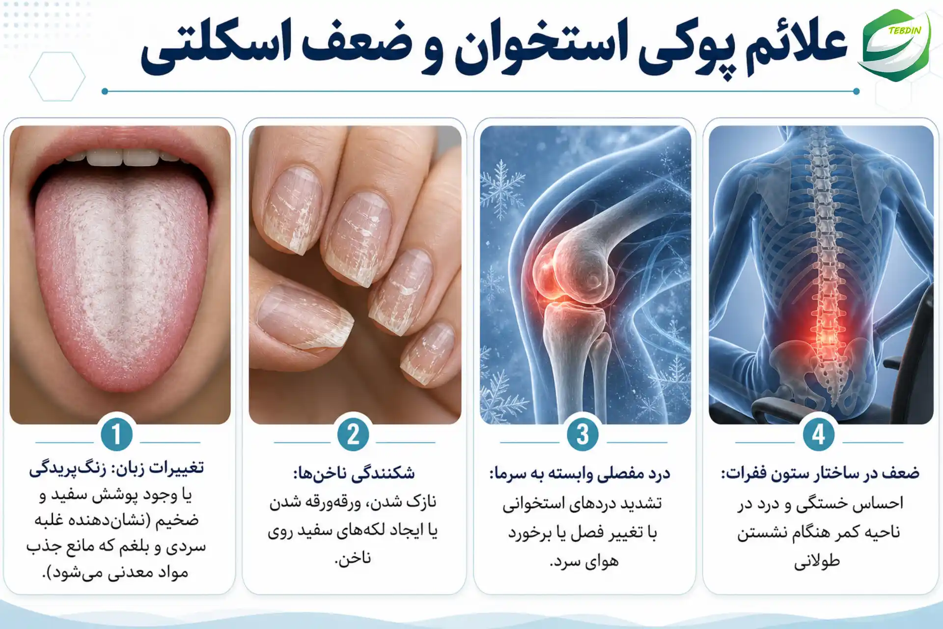 قرص گیاهی استخوان ساز 4 علائم پوکی استخوان و ضعف اسکلتی