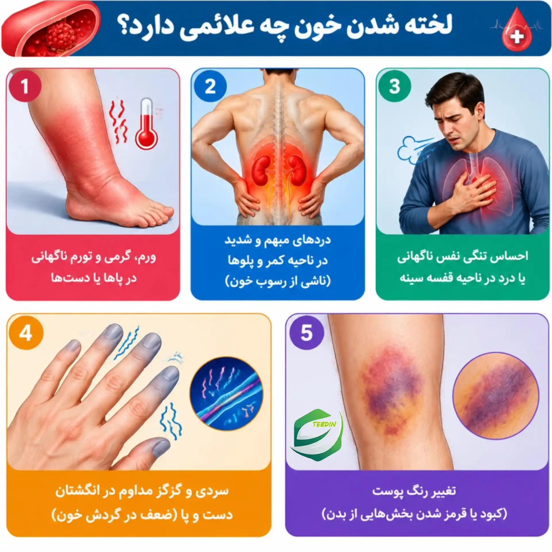 قرص گیاهی لخته خون 4 لخته شدن خون چه علائمی دارد؟